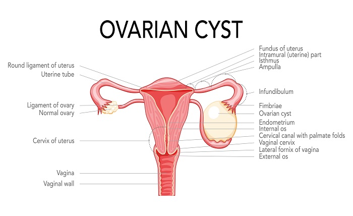 GYNECOLOGY